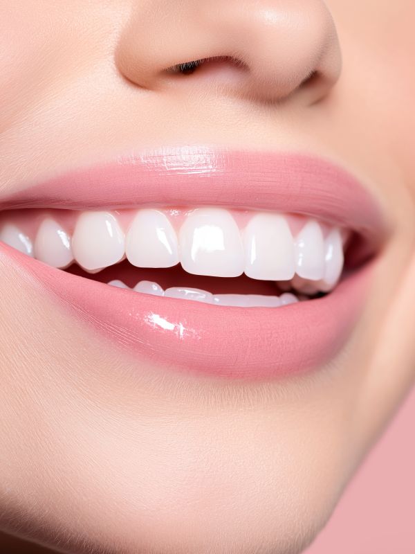 Smile 491833fa
