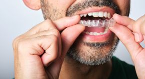mans lower face while putting in a retainer 9a41ee95